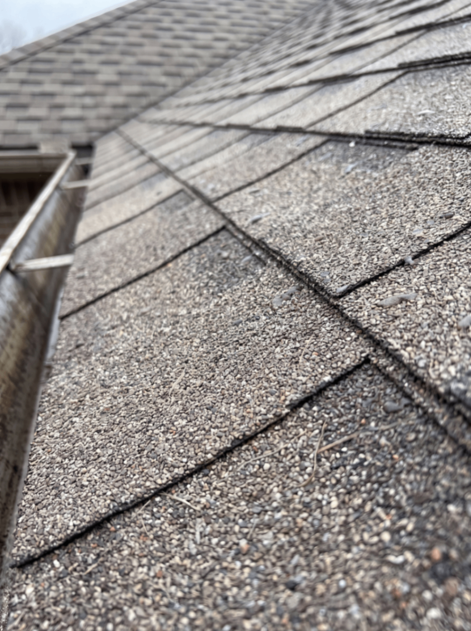 Shingles